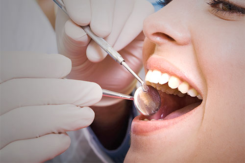 Gum Disease Doesn’t Have to Be Serious (Video)